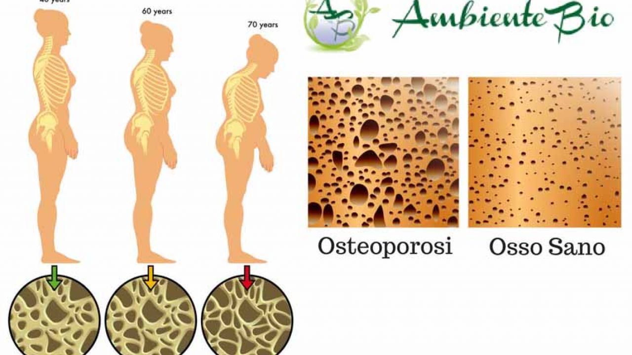 prevenire l’osteoporosi