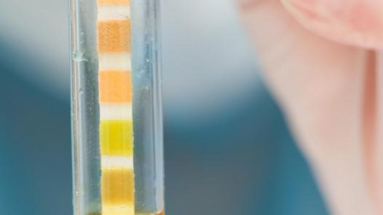 colore urine