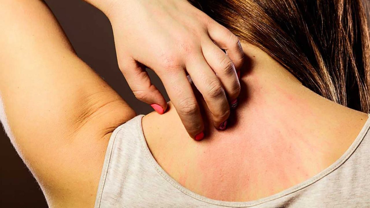 come disintossicarsi dal nichel