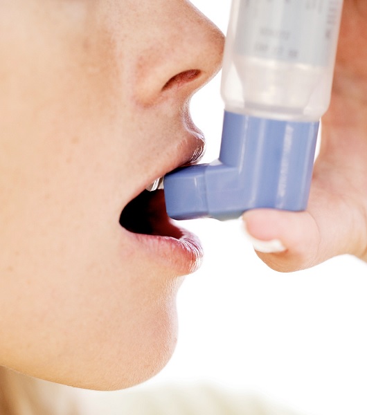 La vitamina D aiuta contro gli attacchi d'asma? Lo studio Uk