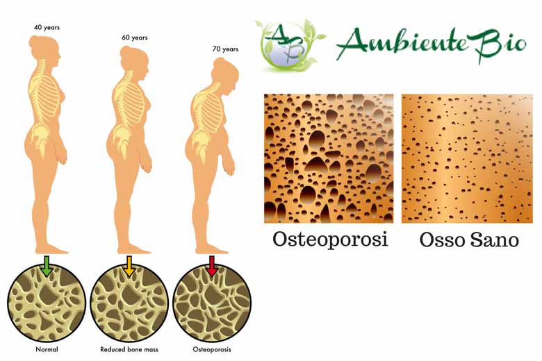 prevenire l’osteoporosi