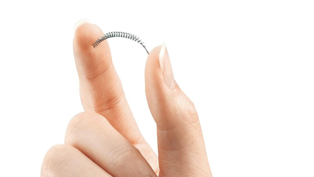 Essure