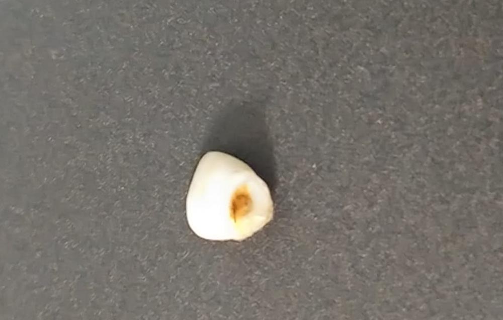 DENTINO DA LATTE