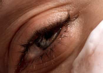 rughe sotto gli occhi